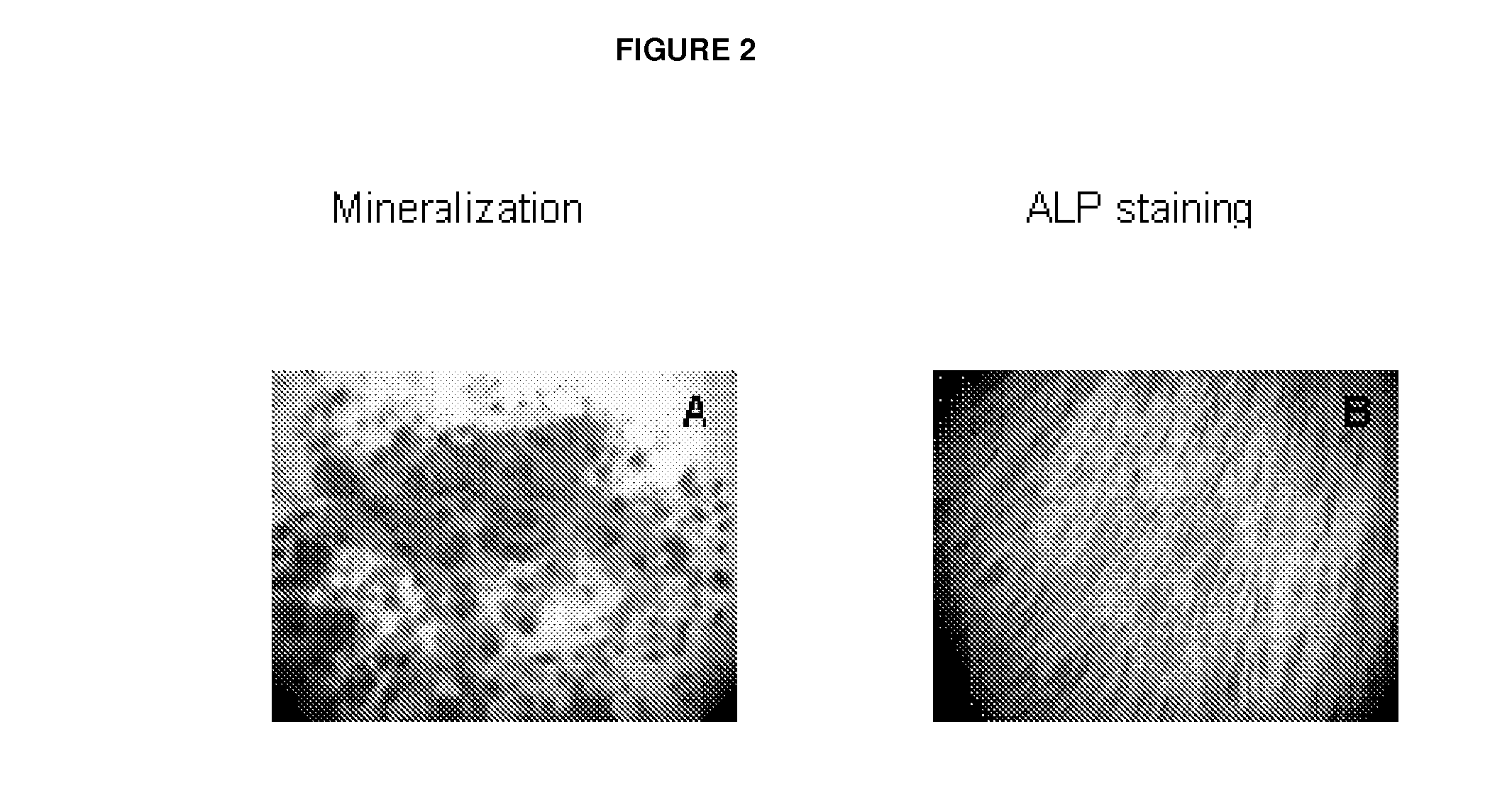 Human Bone-Forming Cells In The Treatment of Inflammatory Rheumatic Diseases