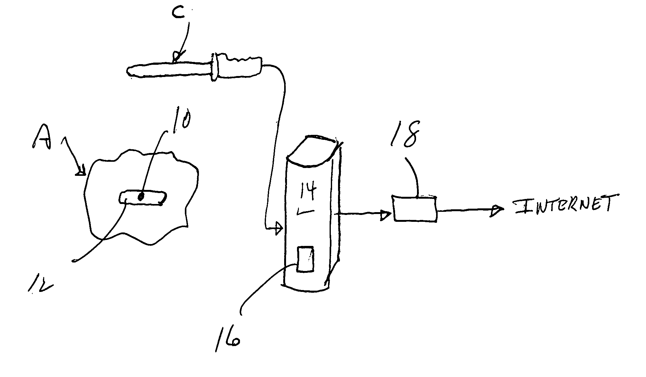 Tracking system for prosthetic and implantable devices