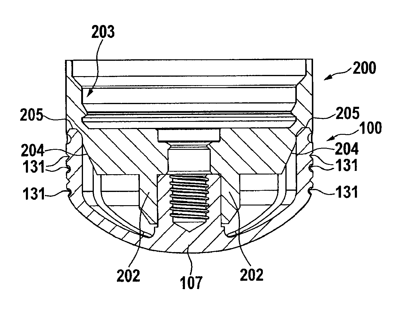 Stemless shoulder implant