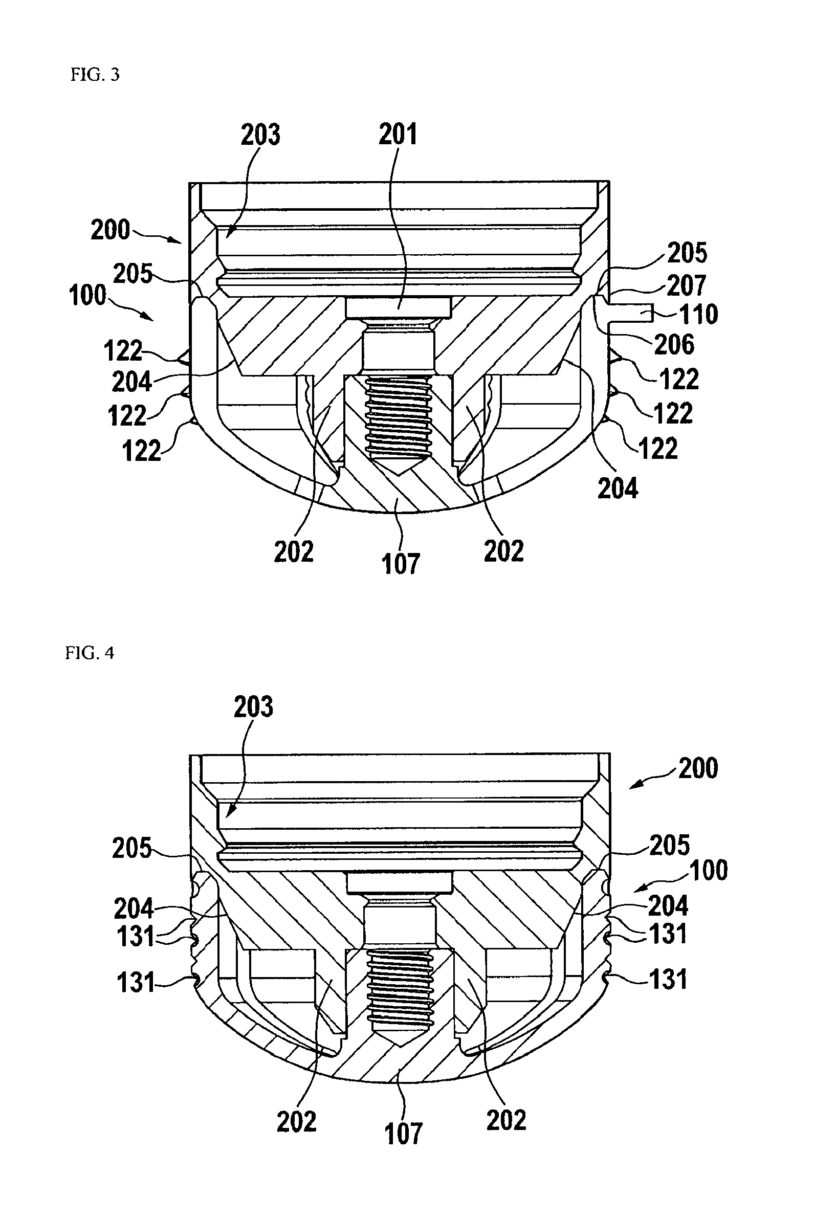 Stemless shoulder implant