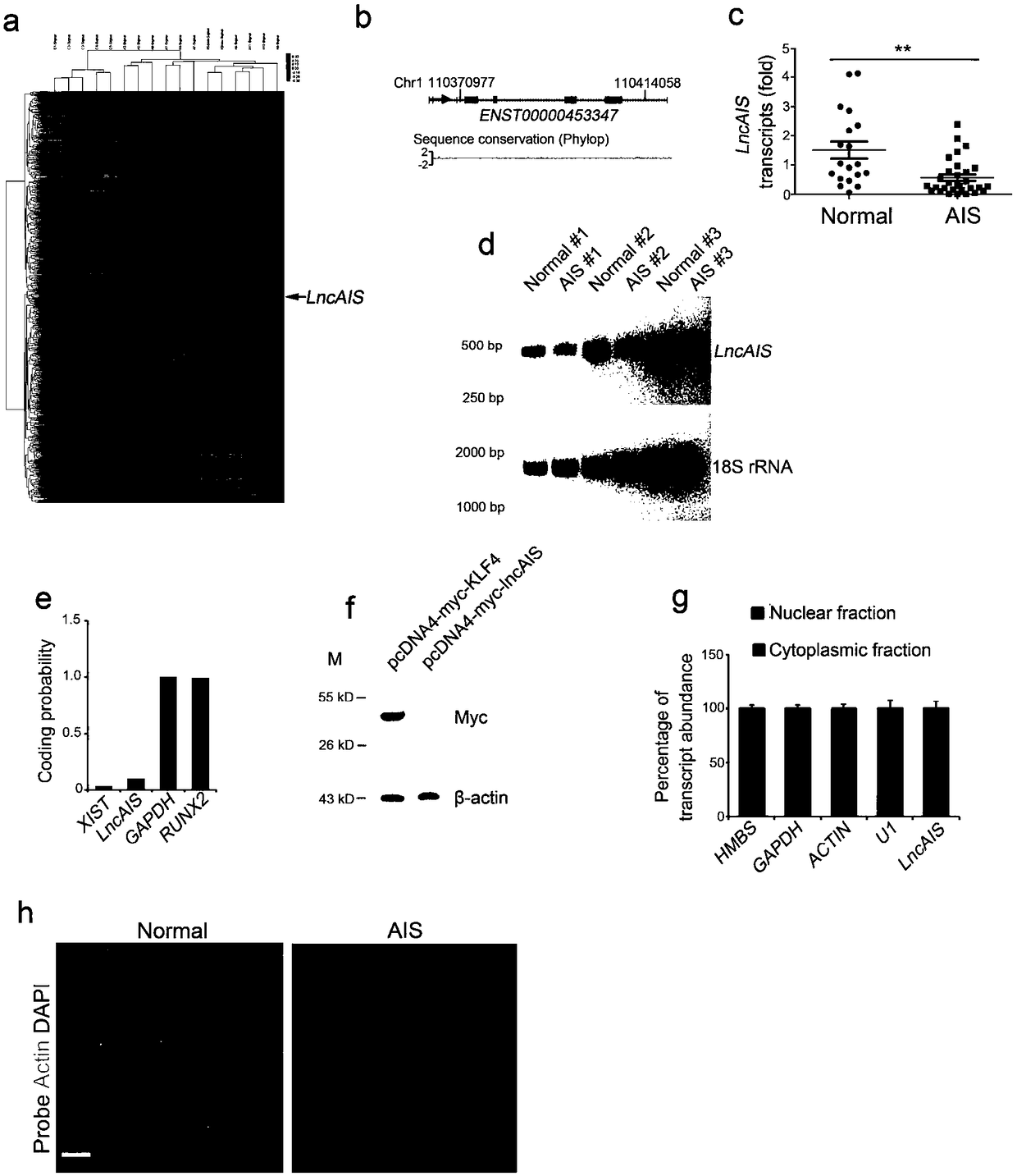 lncRNA marker lncAIS of adolescent idiopathic scoliosis (AIS) and application of lncAIS in preparation of AIS detection, prognosis, prevention or treatment products