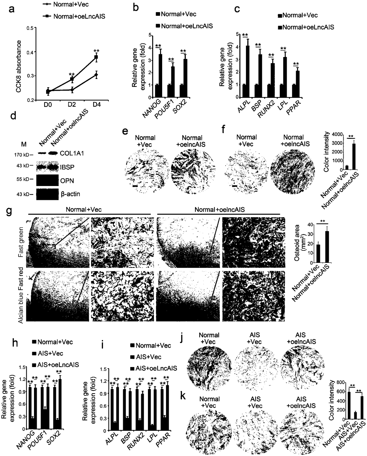 lncRNA marker lncAIS of adolescent idiopathic scoliosis (AIS) and application of lncAIS in preparation of AIS detection, prognosis, prevention or treatment products