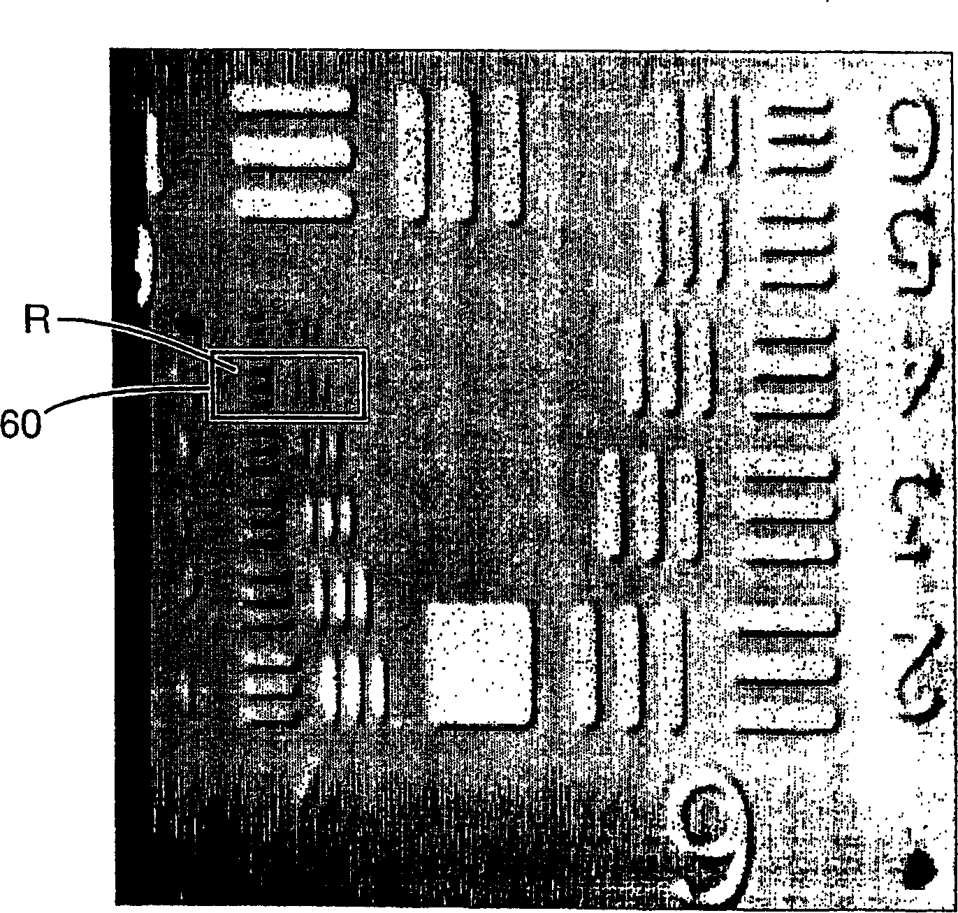 Scanning laser microscope with wave-front sensor