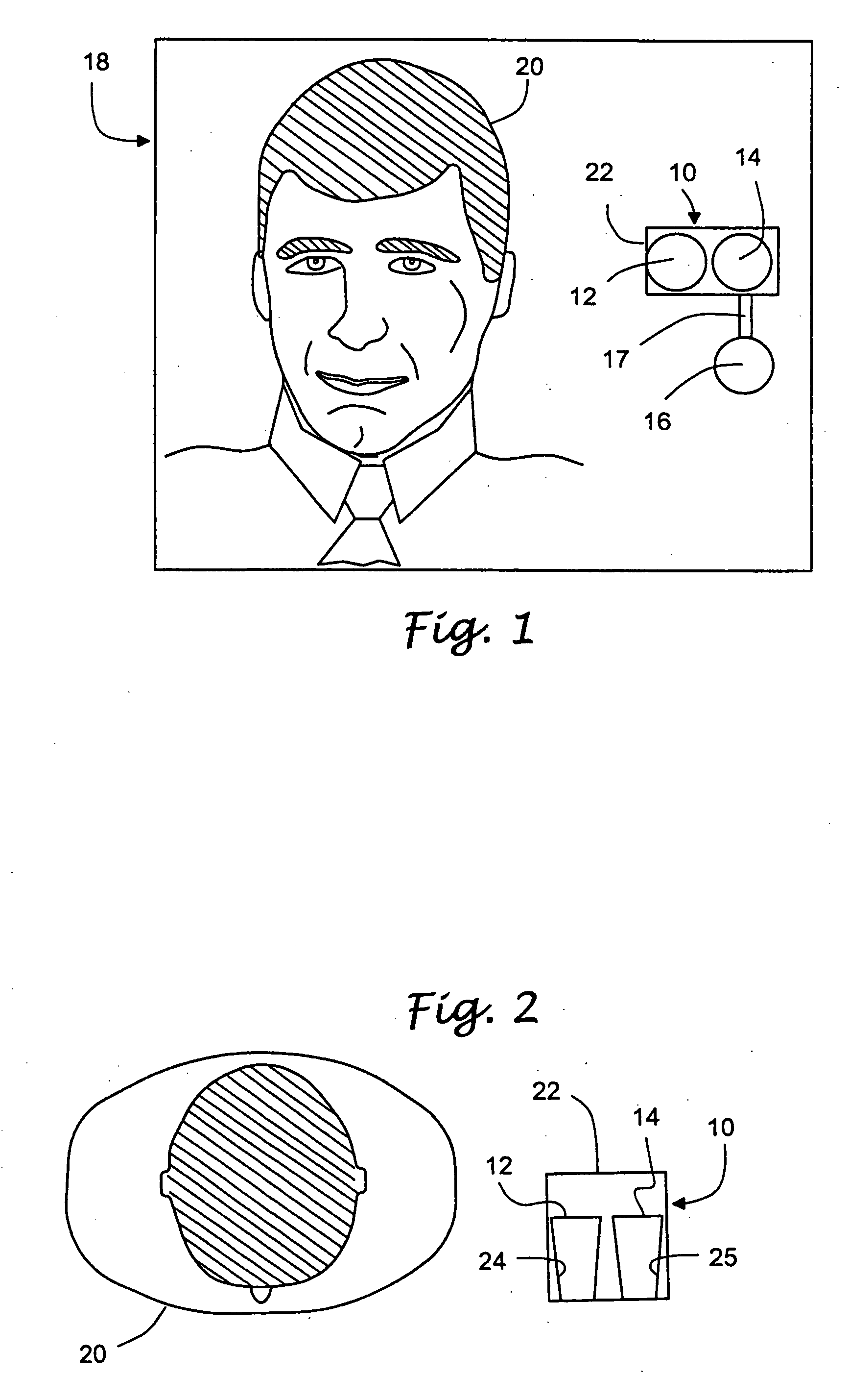 Methods and apparatus for a remote, noninvasive technique to detect core body temperature in a subject via thermal imaging