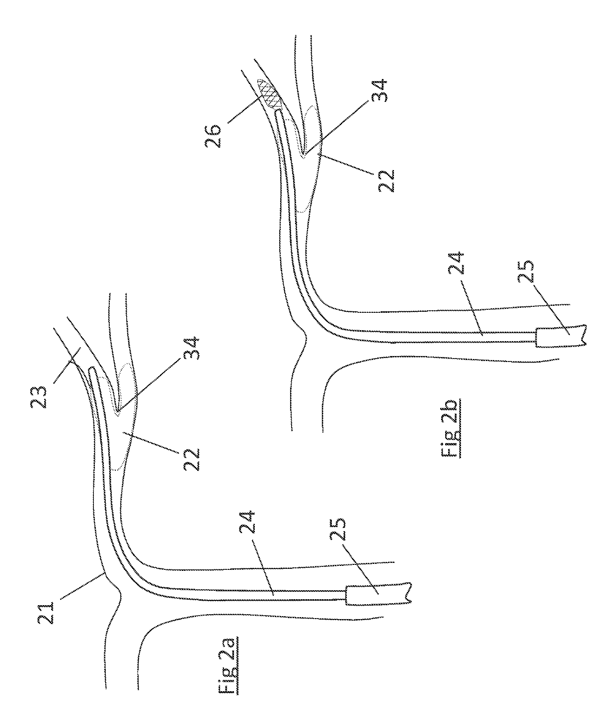 Clot retrieval device for removing clot from a blood vessel