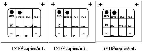 Nucleic acid combined testing kit of respiratory tract infection pathogens