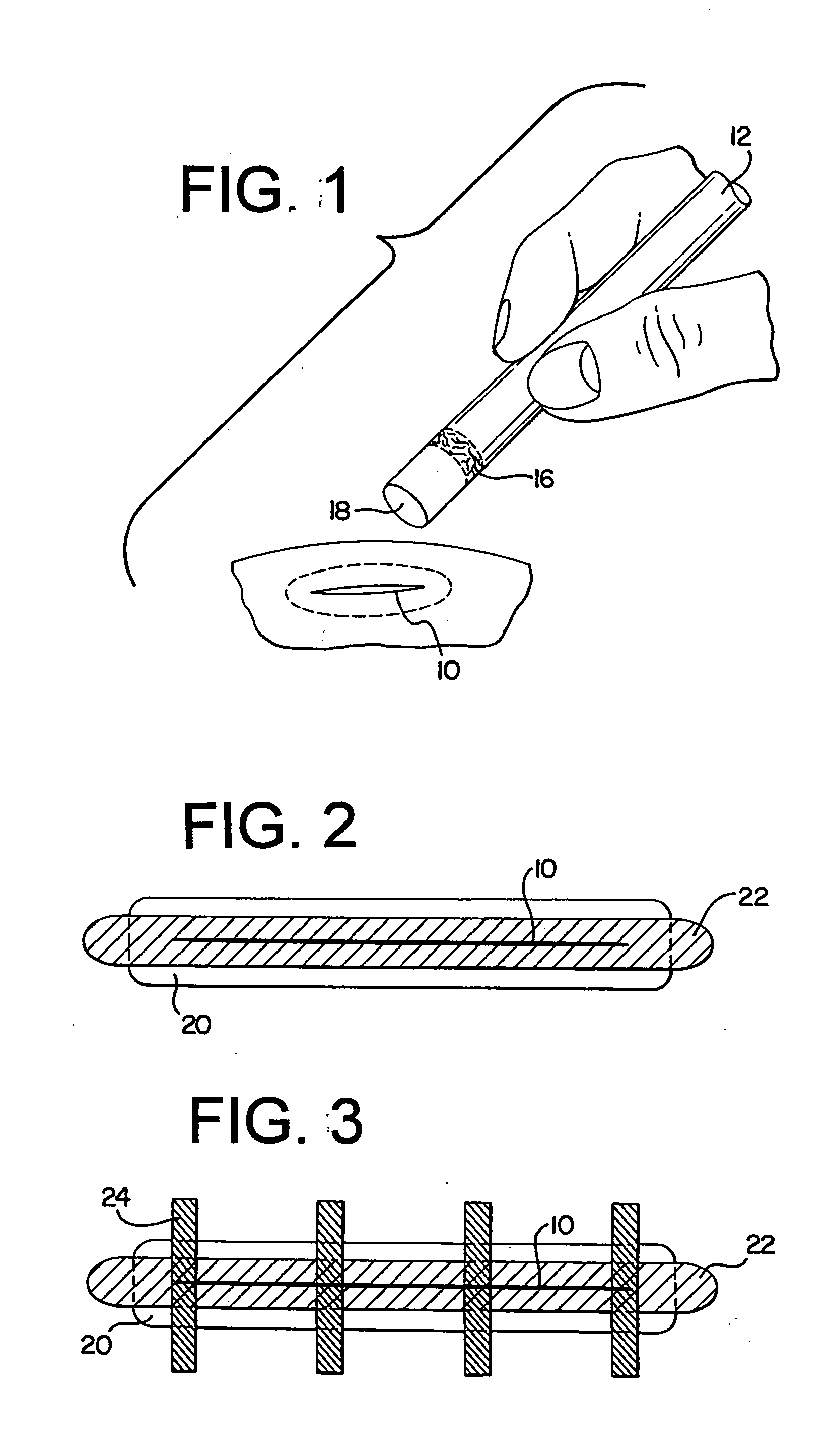 Dressing and method of treatment for a wound