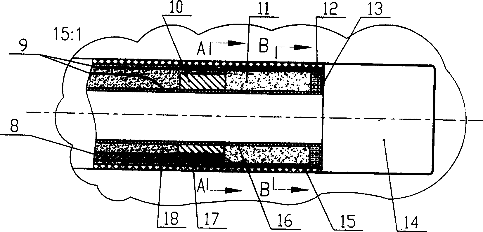 Intervention type tissue hardness supersonic obtaining method and intervening supersonic hardness-detecting device