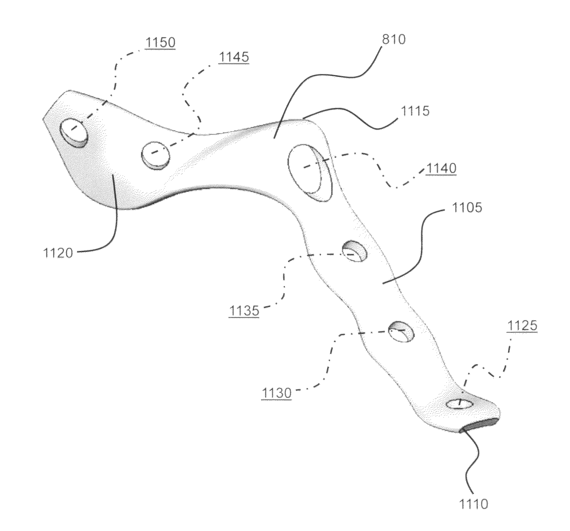 Hybrid intramedullary fixation assembly and method of use