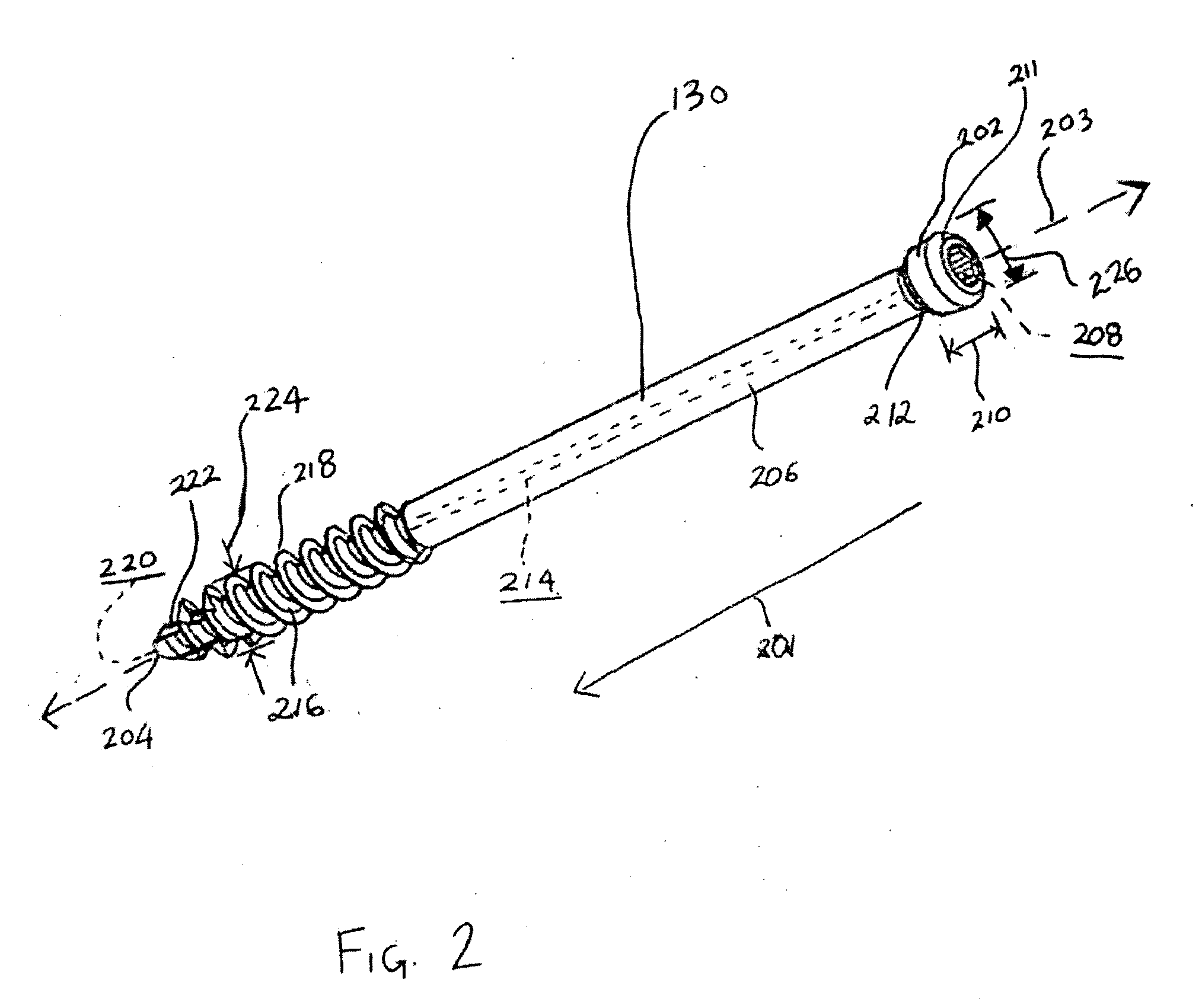 Hybrid intramedullary fixation assembly and method of use