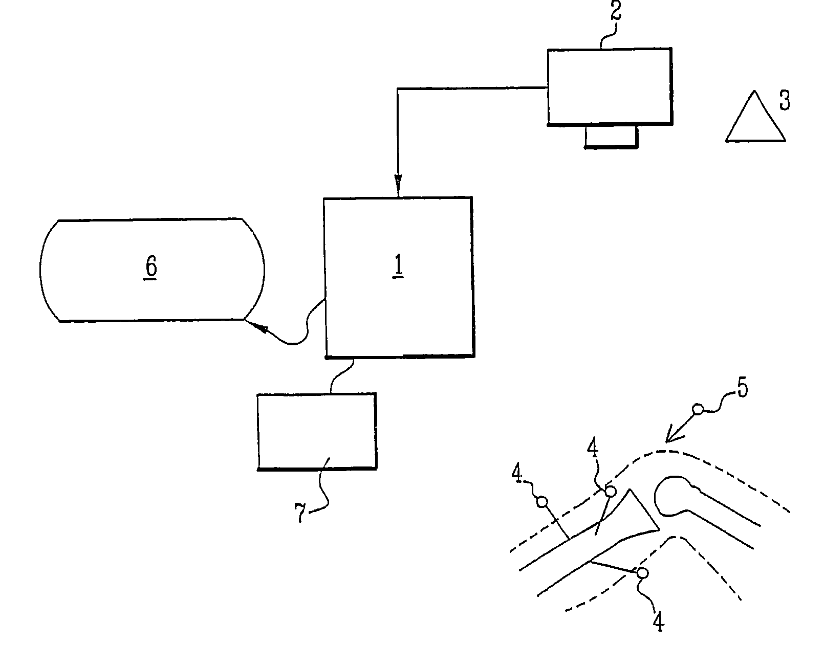 Methods for selecting knee prosthesis elements and device therefor