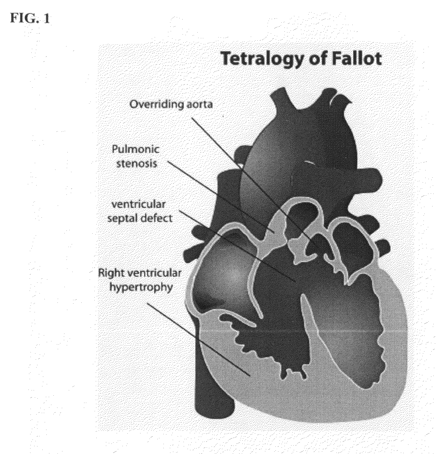 Method and system for dynamic pulmonary trunk modeling in computed tomography and magnetic resonance imaging