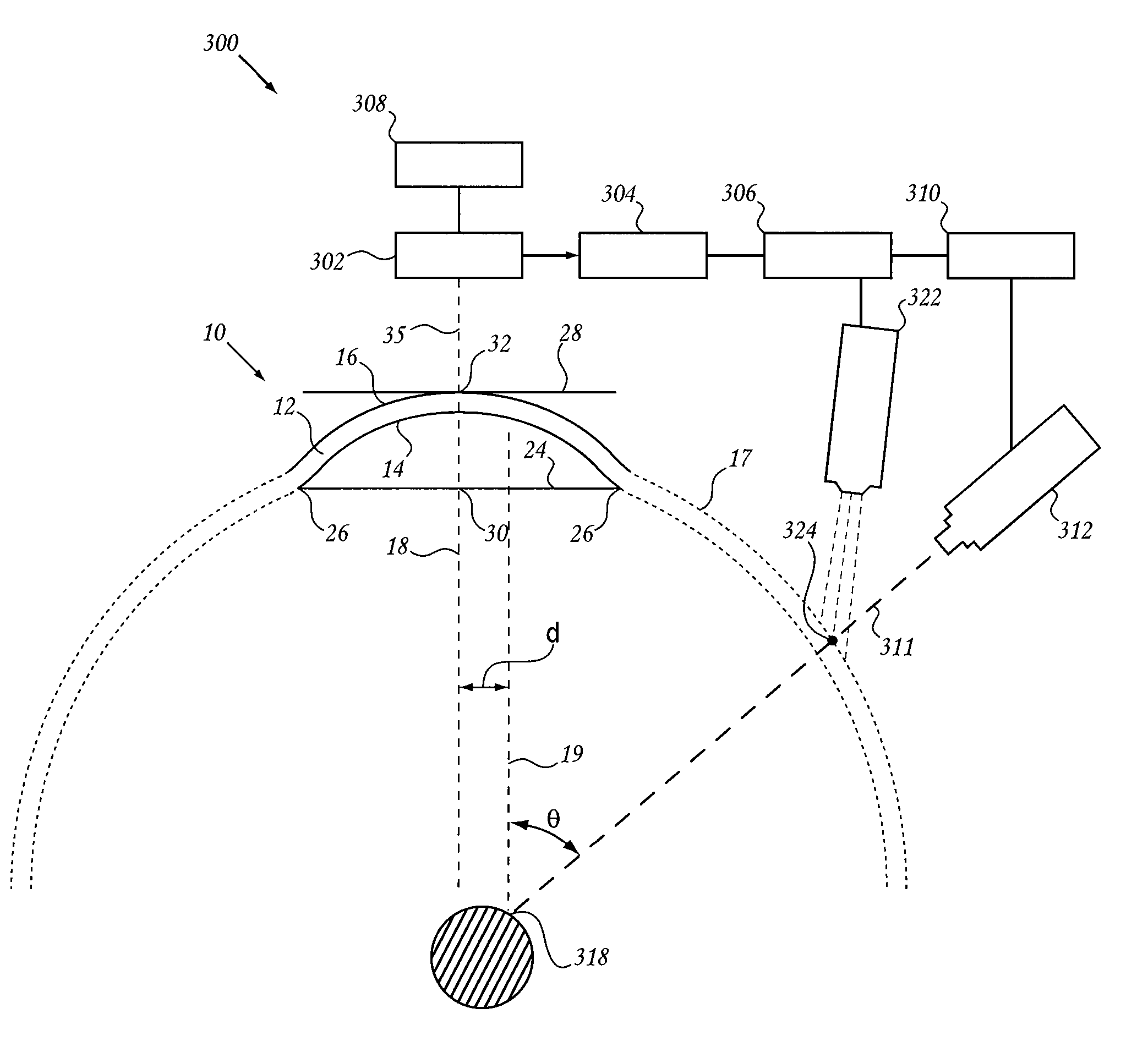 Method and device for ocular alignment and coupling of ocular structures