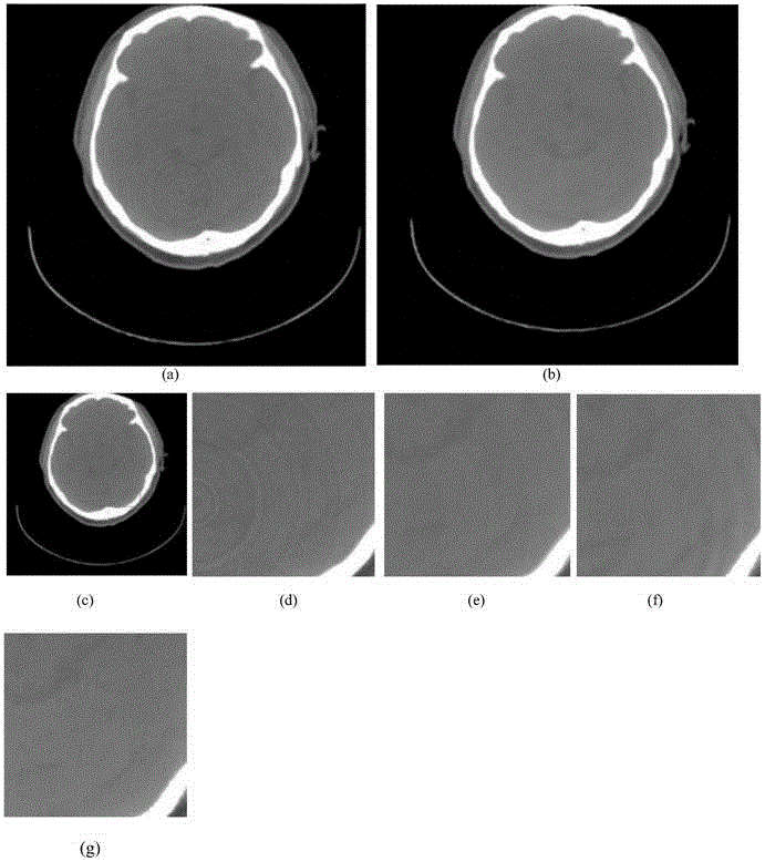 Ring artifact elimination method for CBCT image