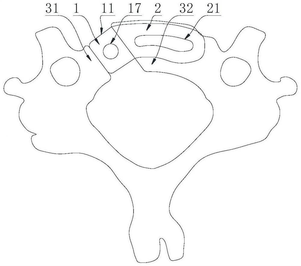 Interbody fusion fixator for lateral anterior-approach vertebral reconstruction