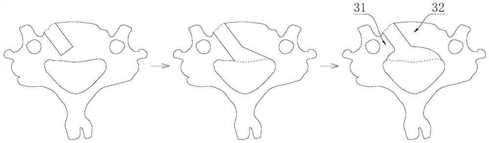 Interbody fusion fixator for lateral anterior-approach vertebral reconstruction