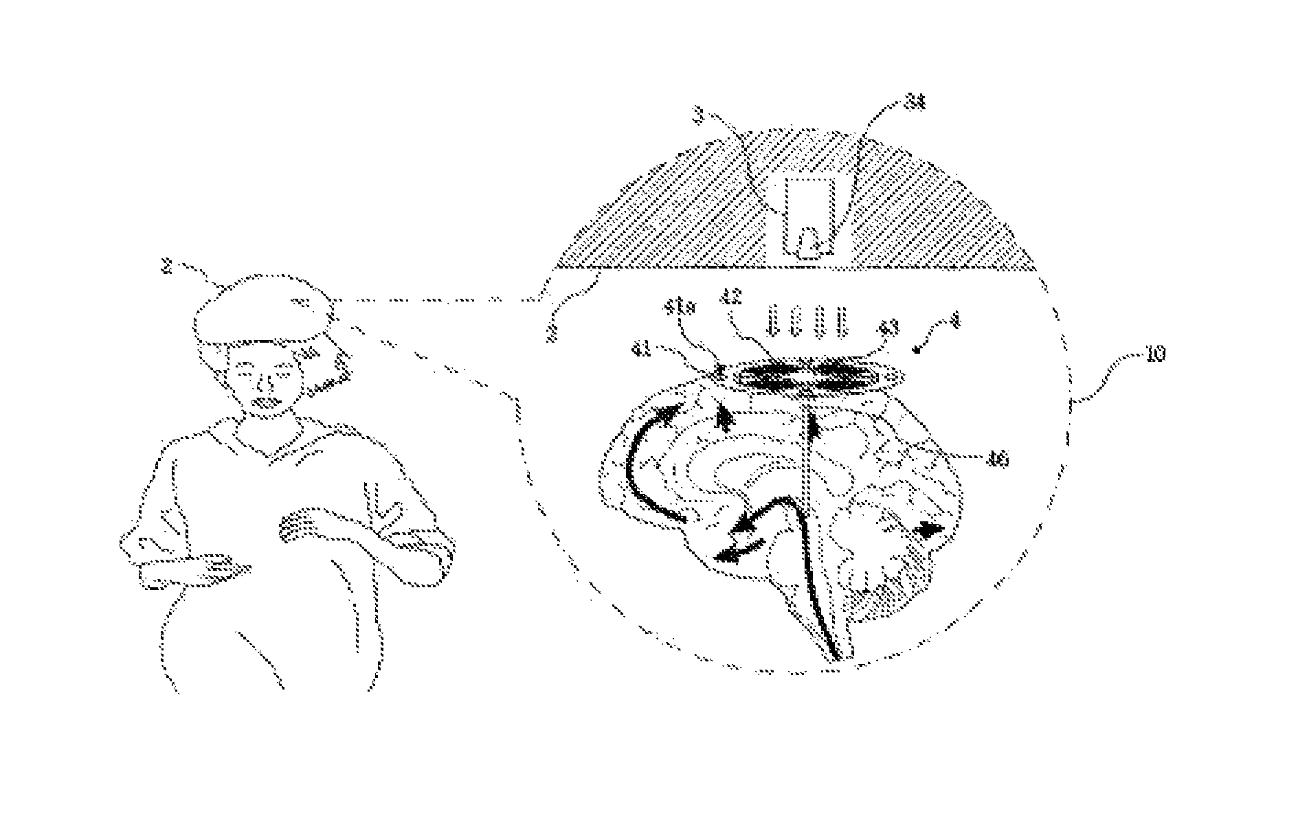 Deep brain stimulation device having wireless power transmission mechanism