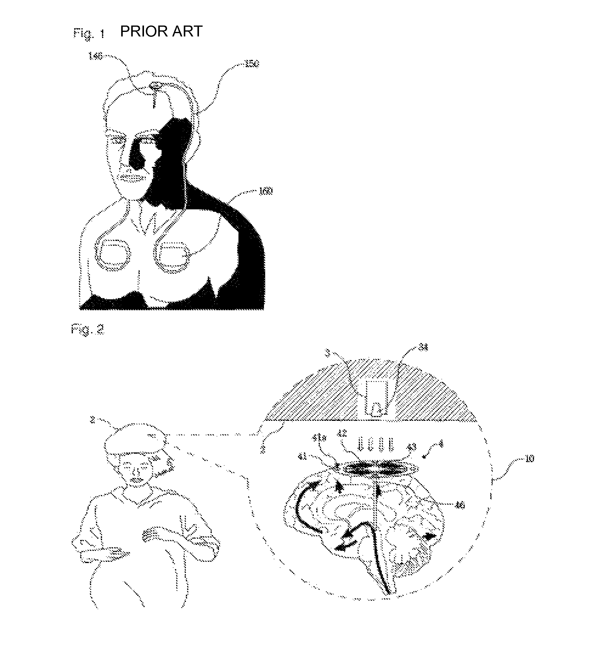 Deep brain stimulation device having wireless power transmission mechanism