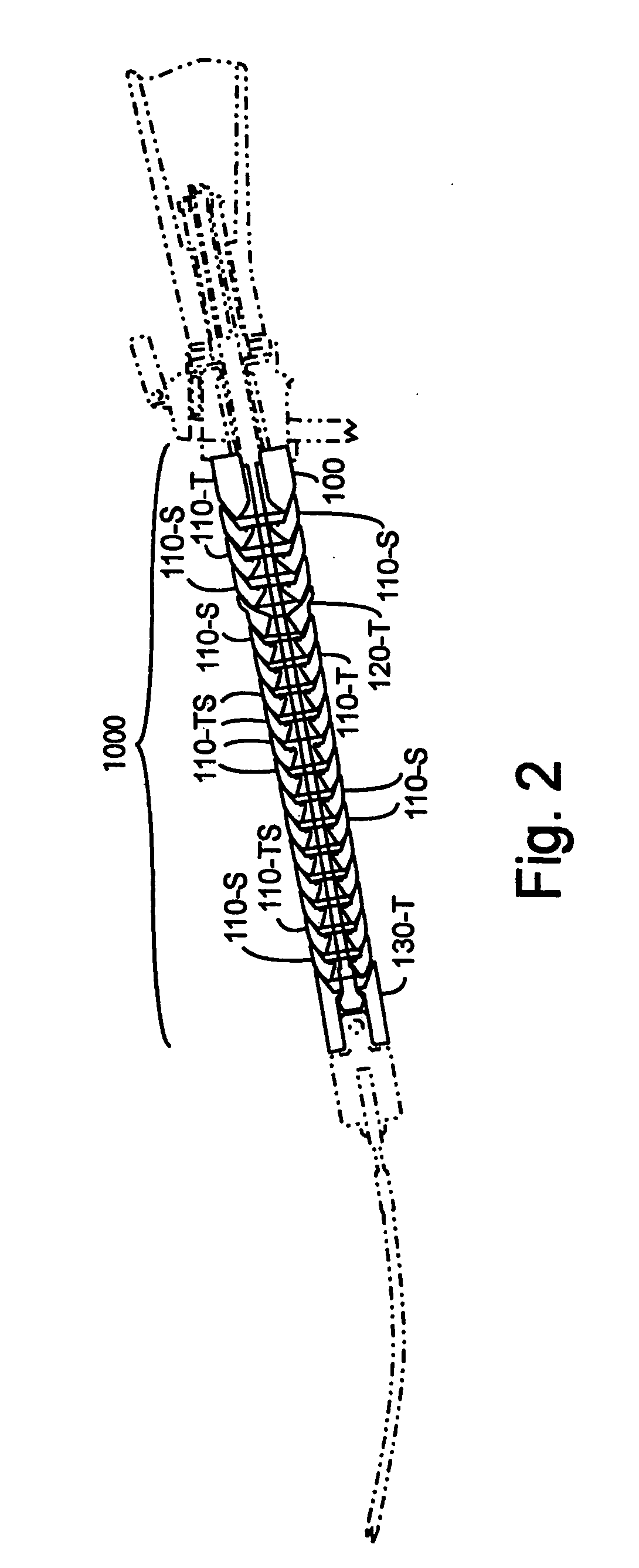 Method and apparatus for improved stiffness in the linkage assembly of a flexible arm