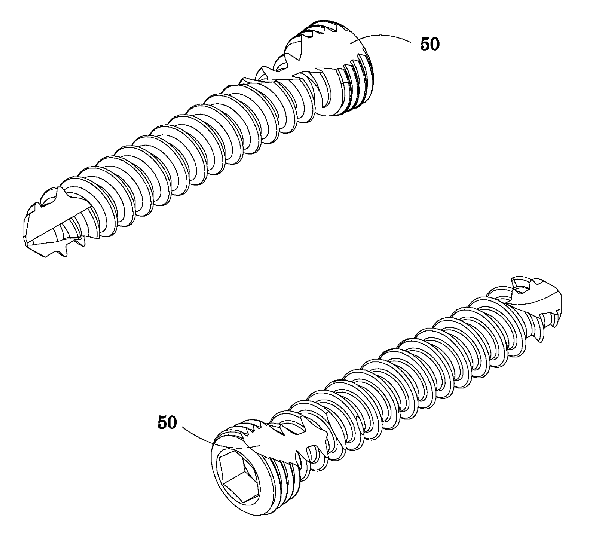 Bone fixation system