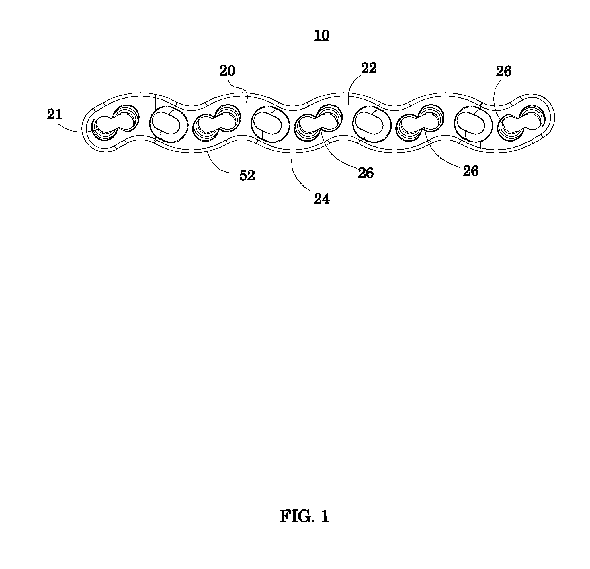 Bone fixation system