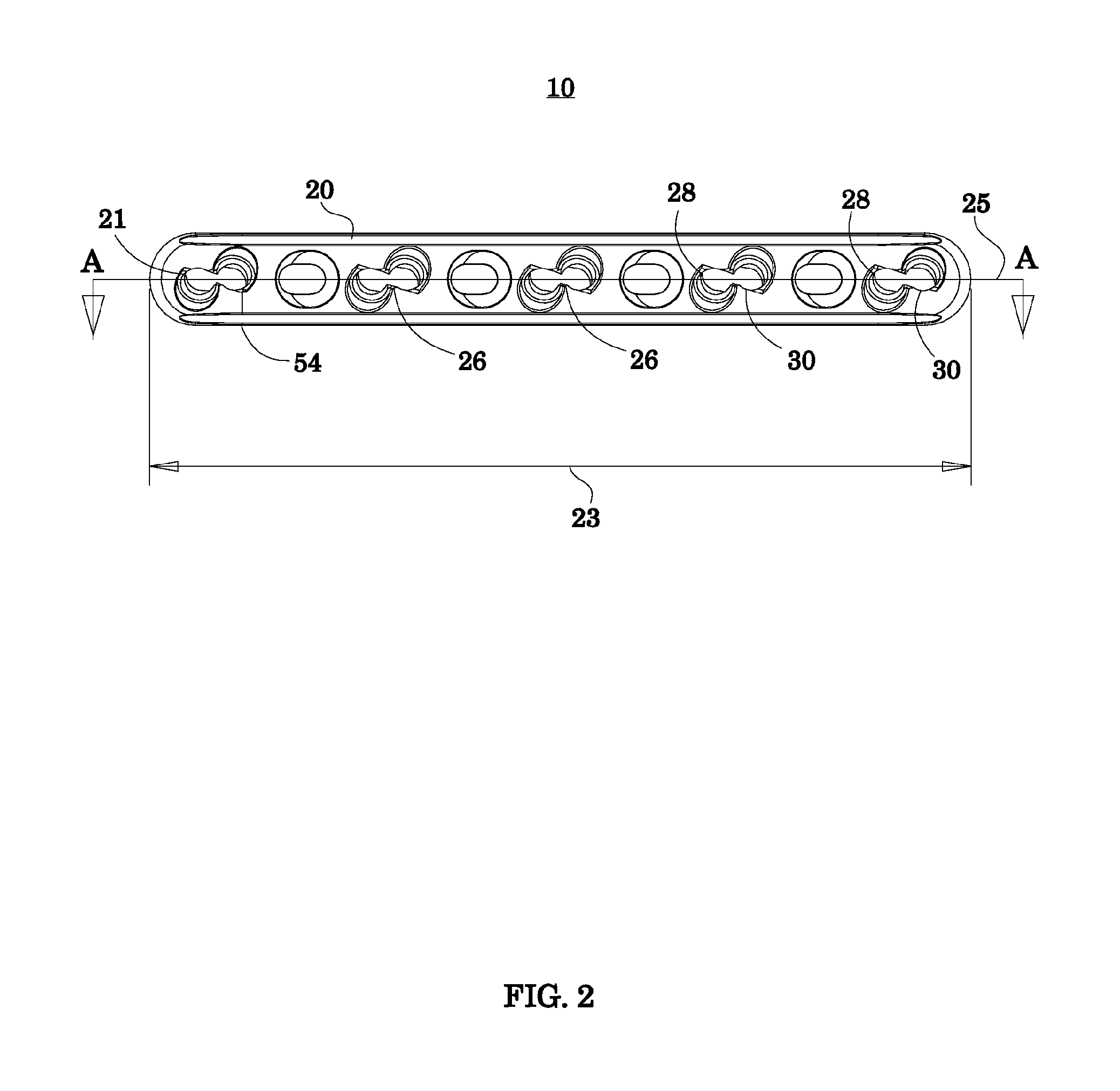 Bone fixation system