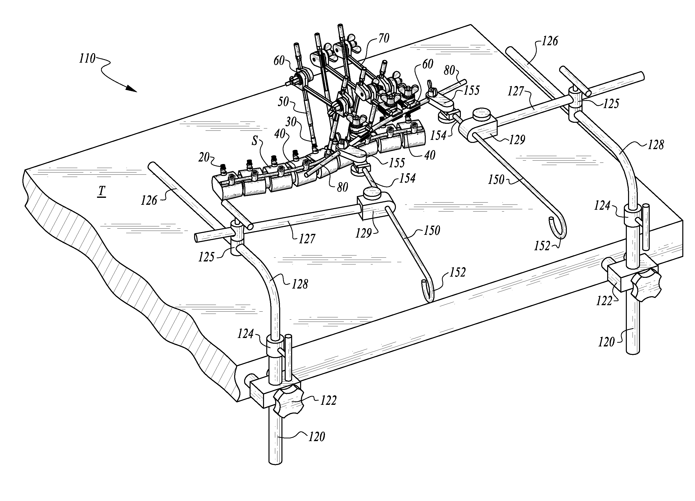 Table anchored scoliosis de-rotation system and method