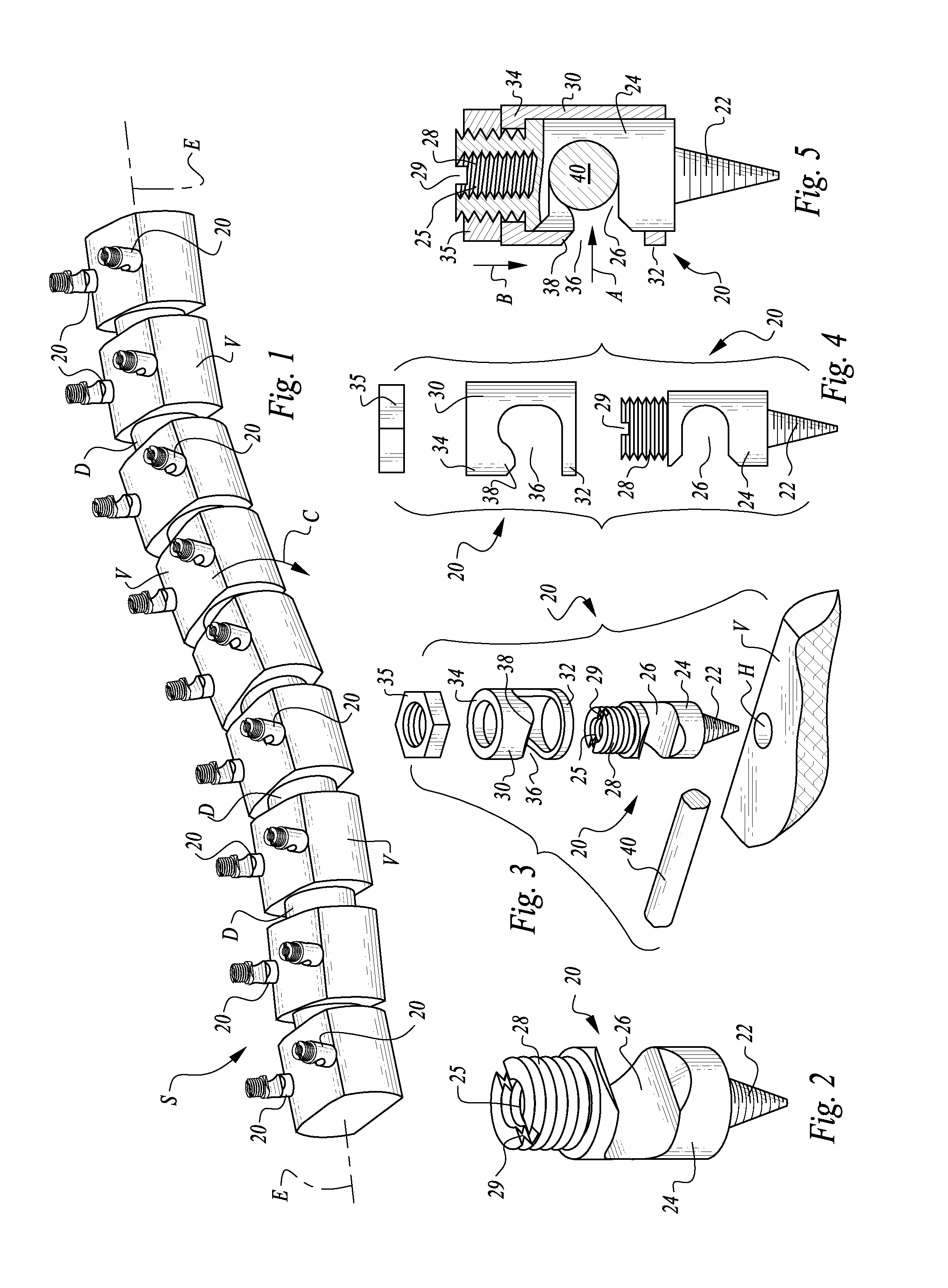 Table anchored scoliosis de-rotation system and method