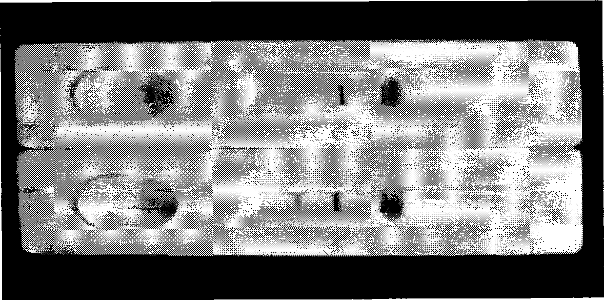 Kidney syndrome blooding diagnosis test paper strip, preparing method and detection reagent kit thereof