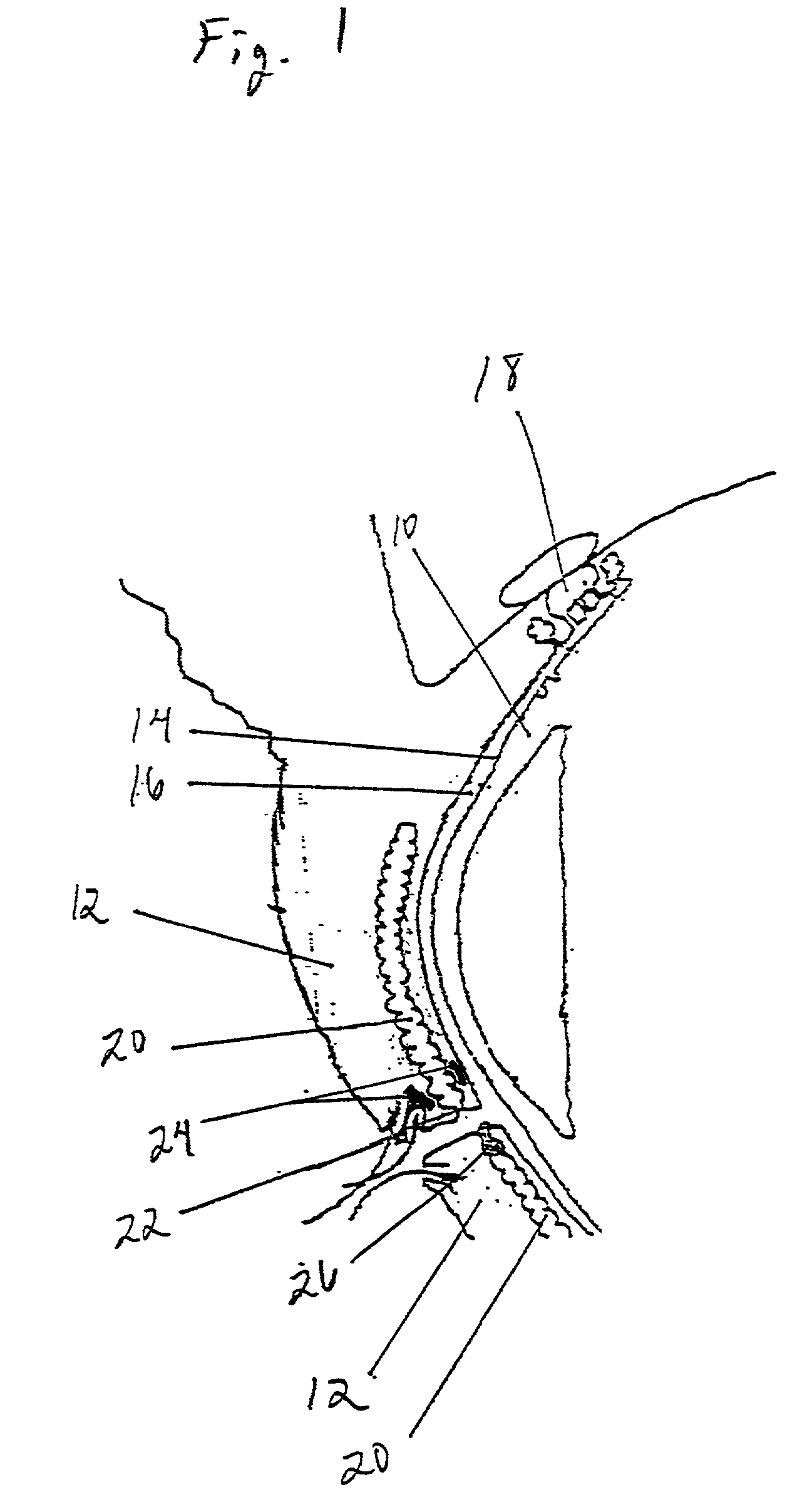 Method and apparatus for preventing and treating eyelid problems