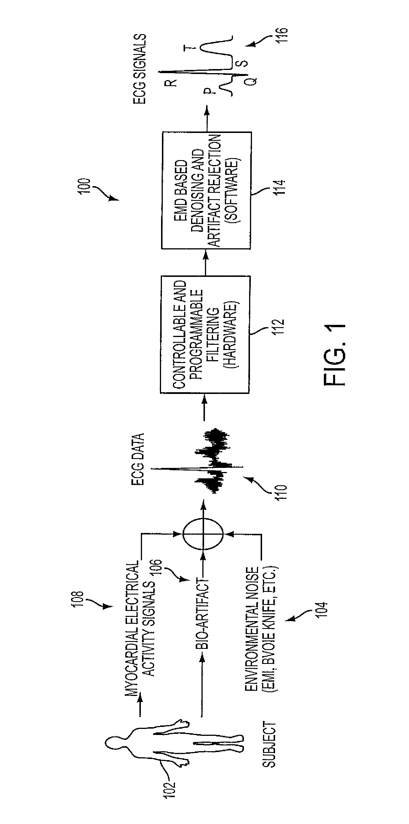 Denoising and Artifact Rejection For Cardiac Signal in a Sensis System