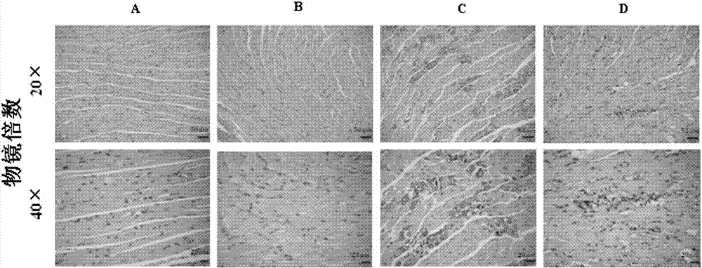 Application of berberine in preparation of drug for treating viral myocarditis diseases caused by coxsackie virus B3