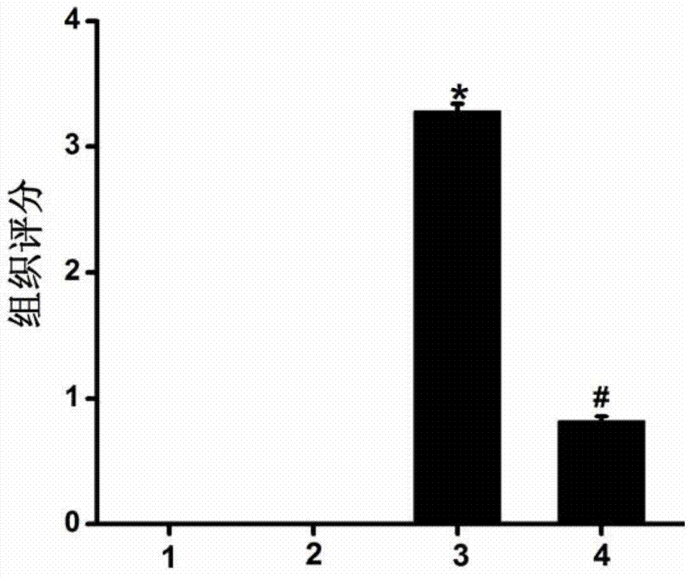 Application of berberine in preparation of drug for treating viral myocarditis diseases caused by coxsackie virus B3