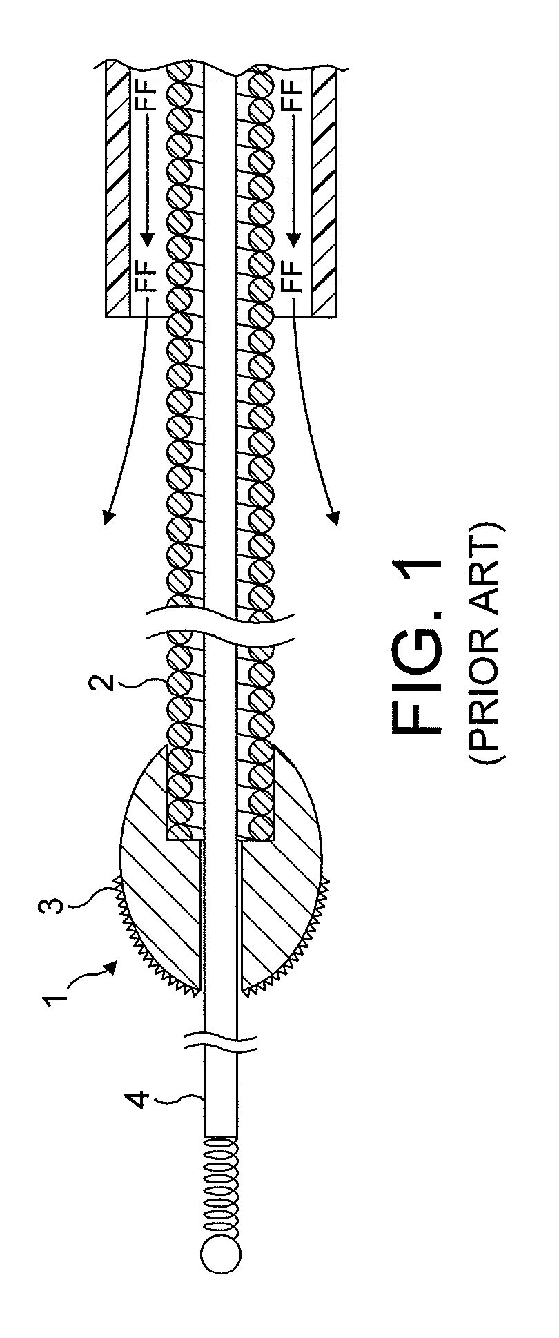 Rotational atherectomy system with enhanced distal protection capability and method of use