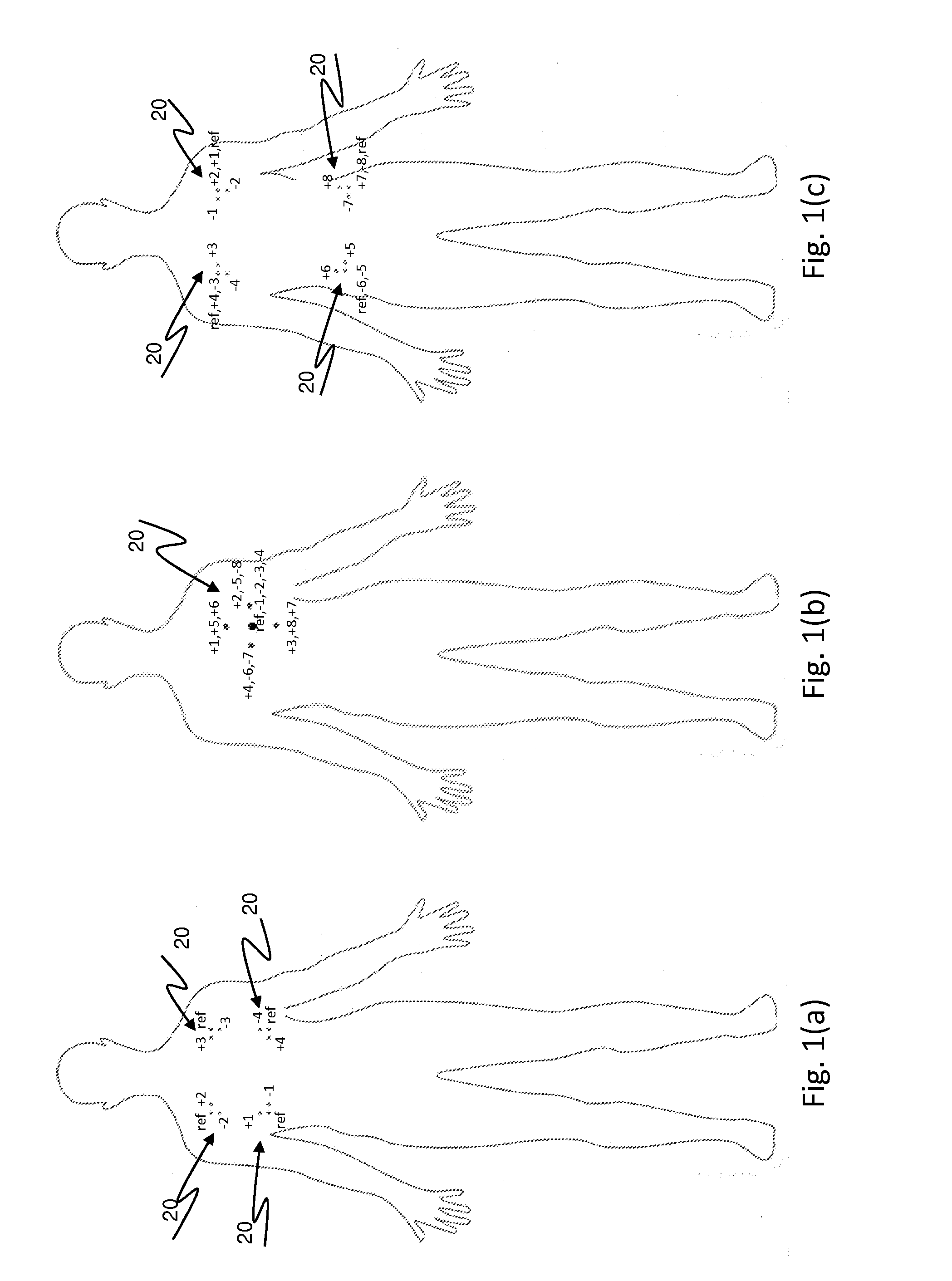 Leadless wireless ECG  measurement system and method for measuring of bio-potential electrical activity of the heart