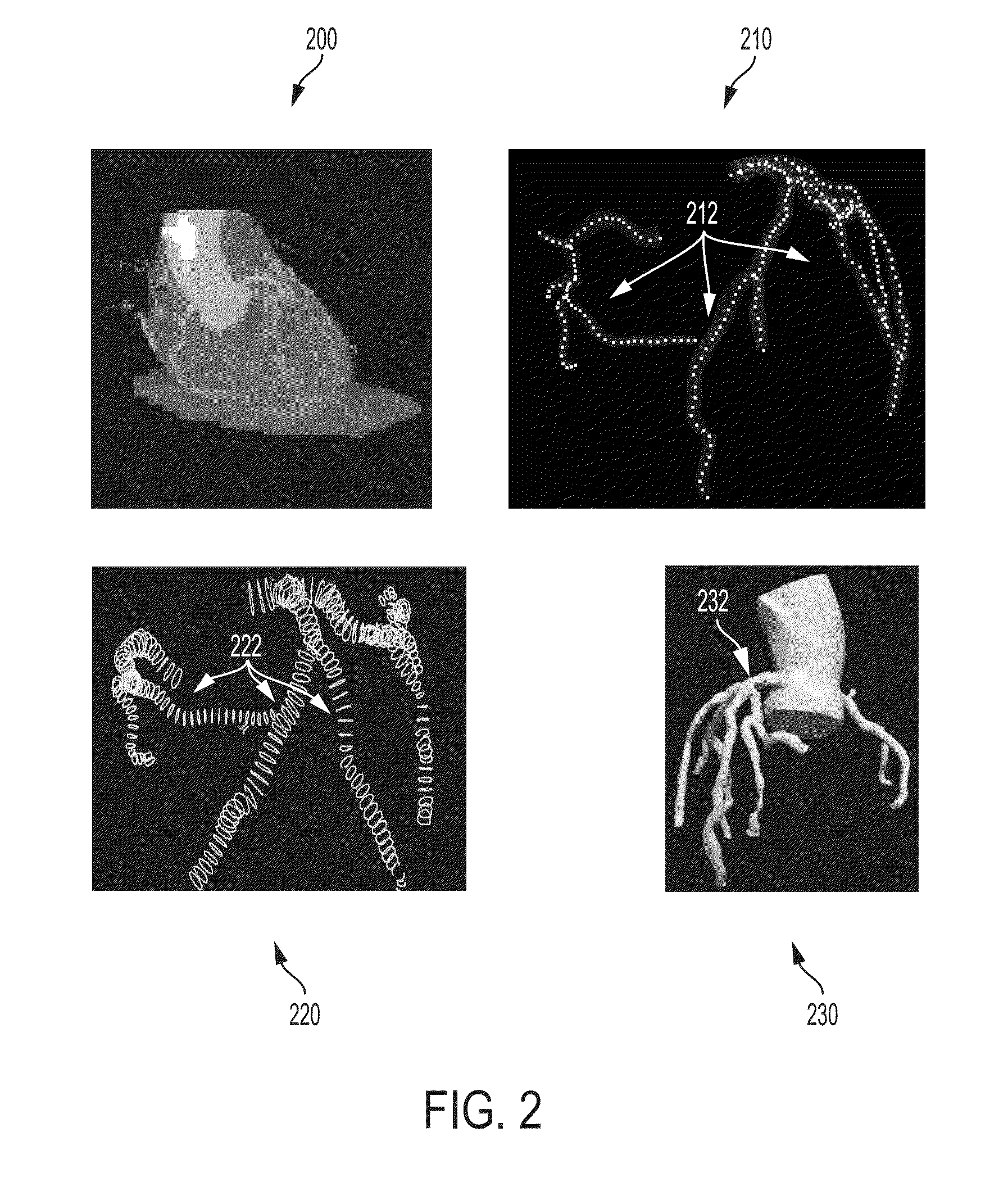 Method and System for Automated Therapy Planning for Arterial Stenosis