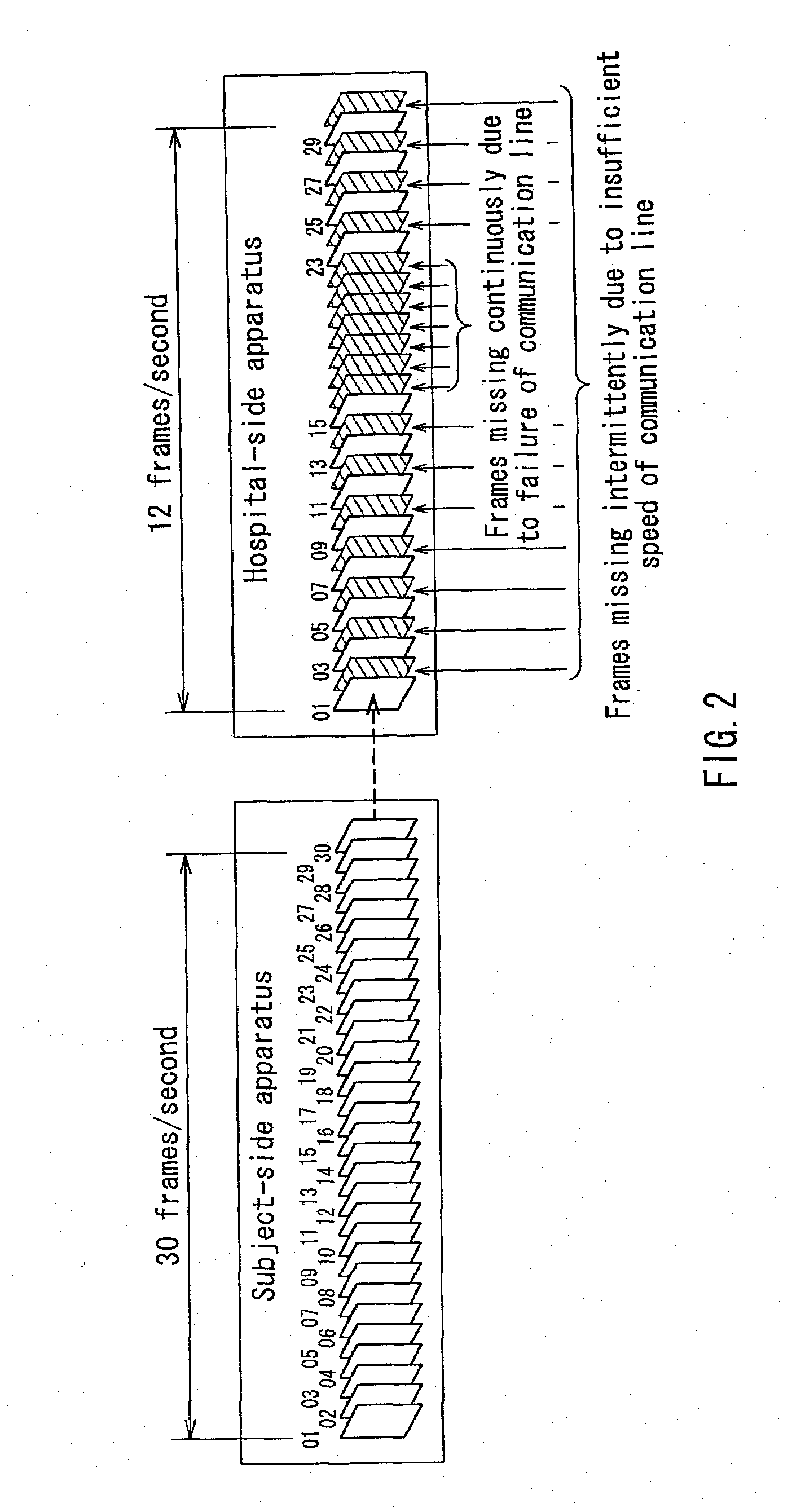 Remote Ultrasonic Diagnostic Subject-Side Apparatus, Remote Ultrasonic Diagnostic Examiner-Side Apparatus and Remote Ultrasonic Diagnostic System