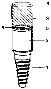 Abutment correction attachment for reducing extended jaw teeth before oral implant restoration