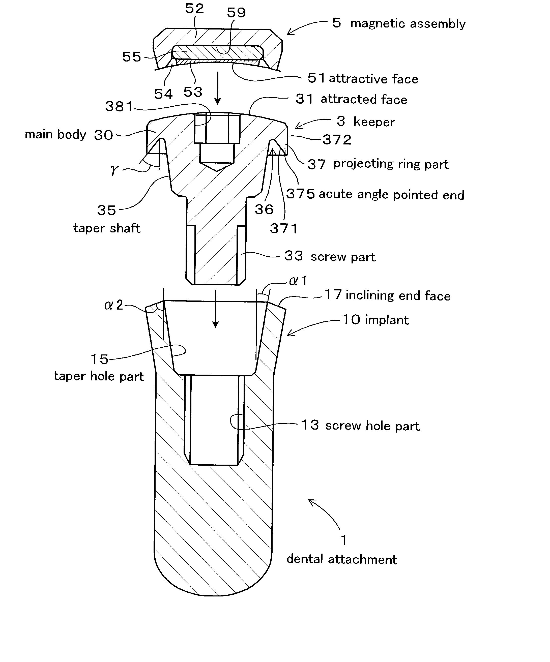 Dental magnetic attachment