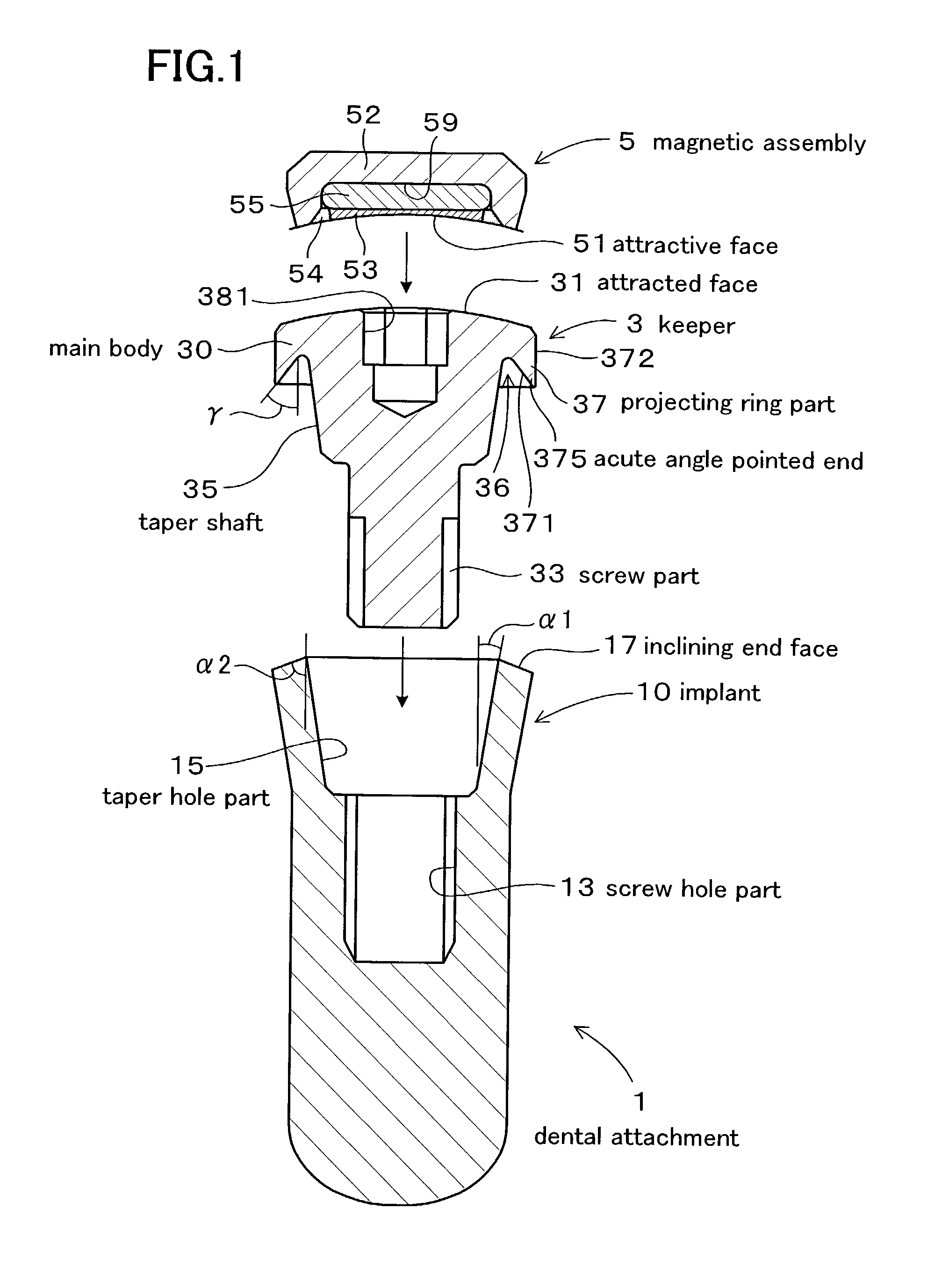 Dental magnetic attachment