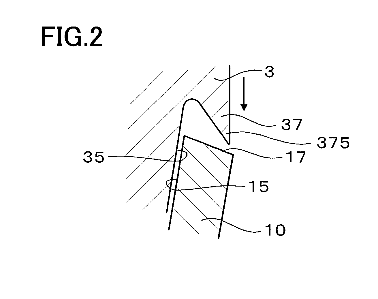 Dental magnetic attachment