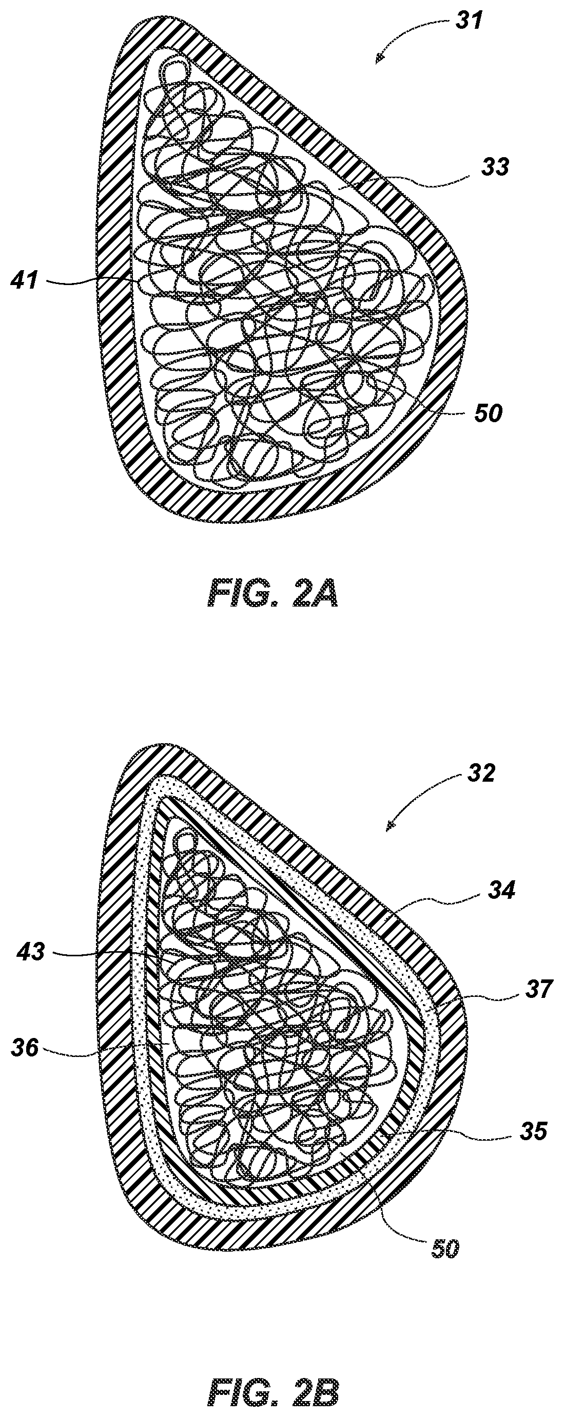 Prosthesis