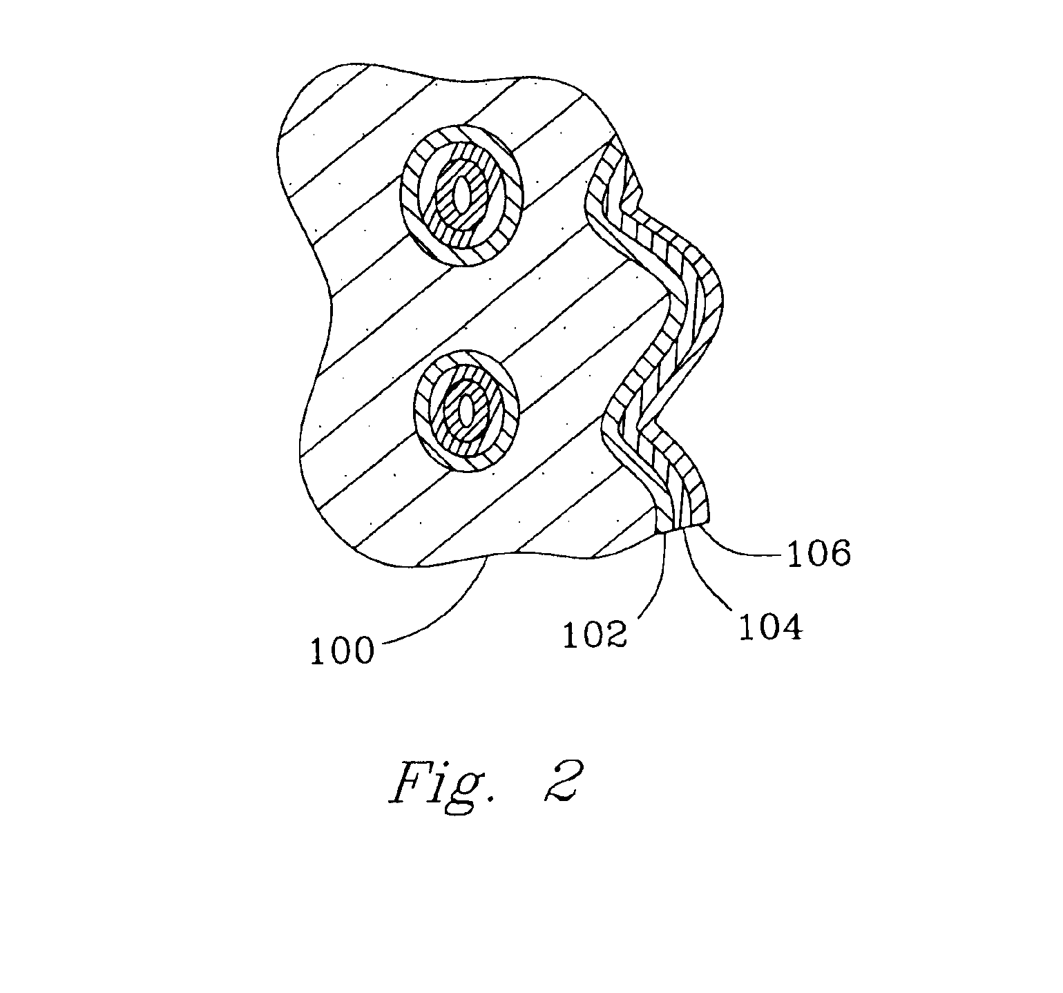 Catalyst structure and method of fischer-tropsch synthesis