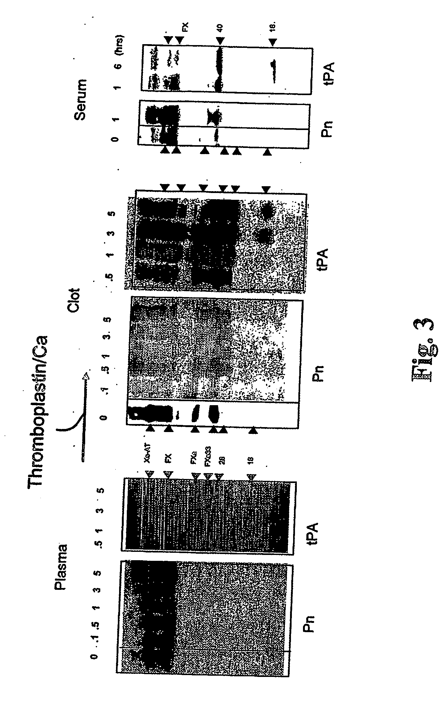 Use of coagulation proteins to lyse clots