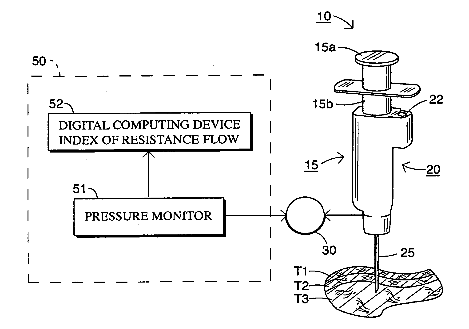 Smart Injection Syring Systems Providing Real-Time User Feedback of Correct Needle Position