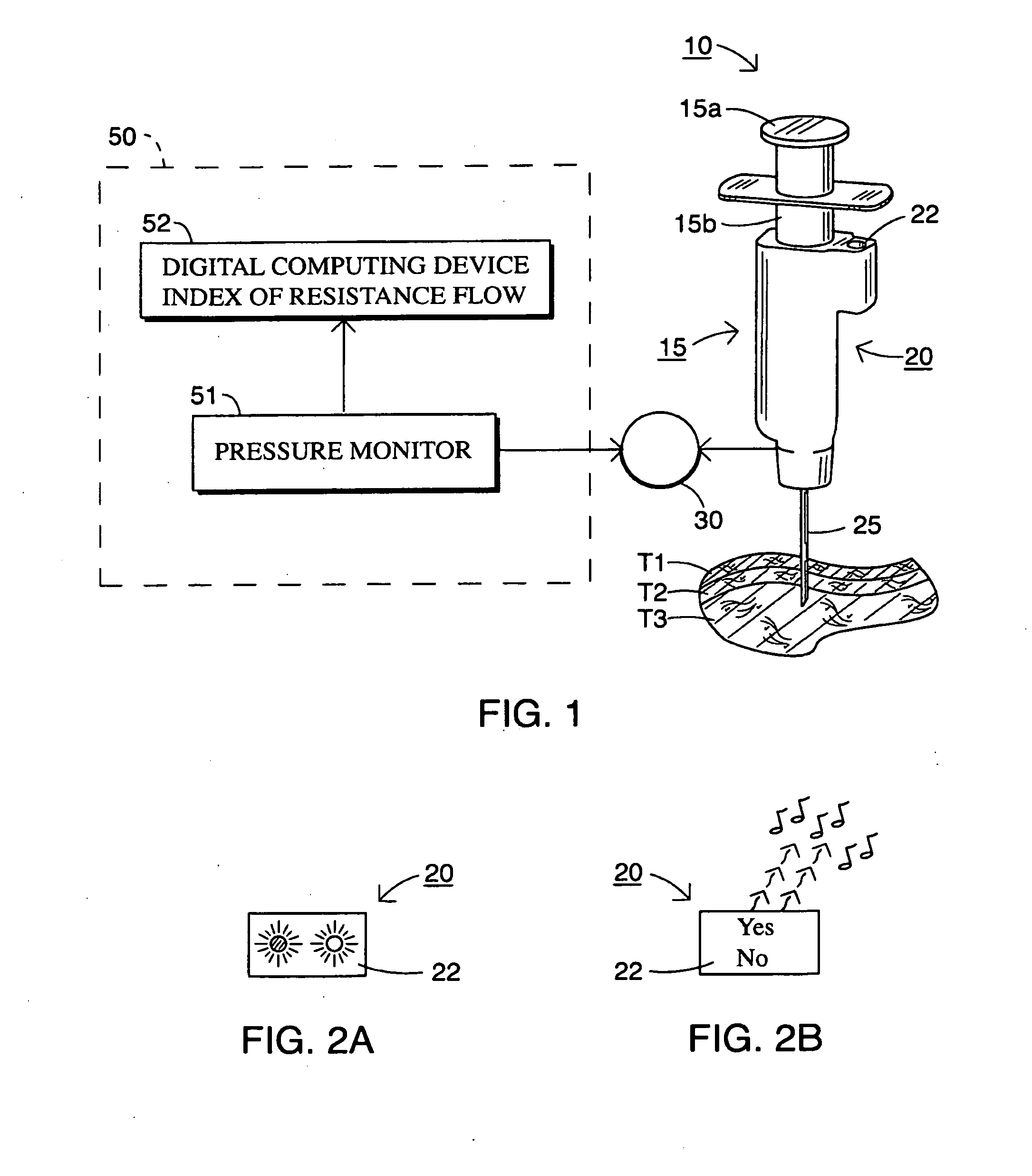 Smart Injection Syring Systems Providing Real-Time User Feedback of Correct Needle Position