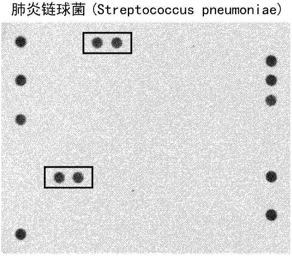 Detection of streptococcus pneumoniae