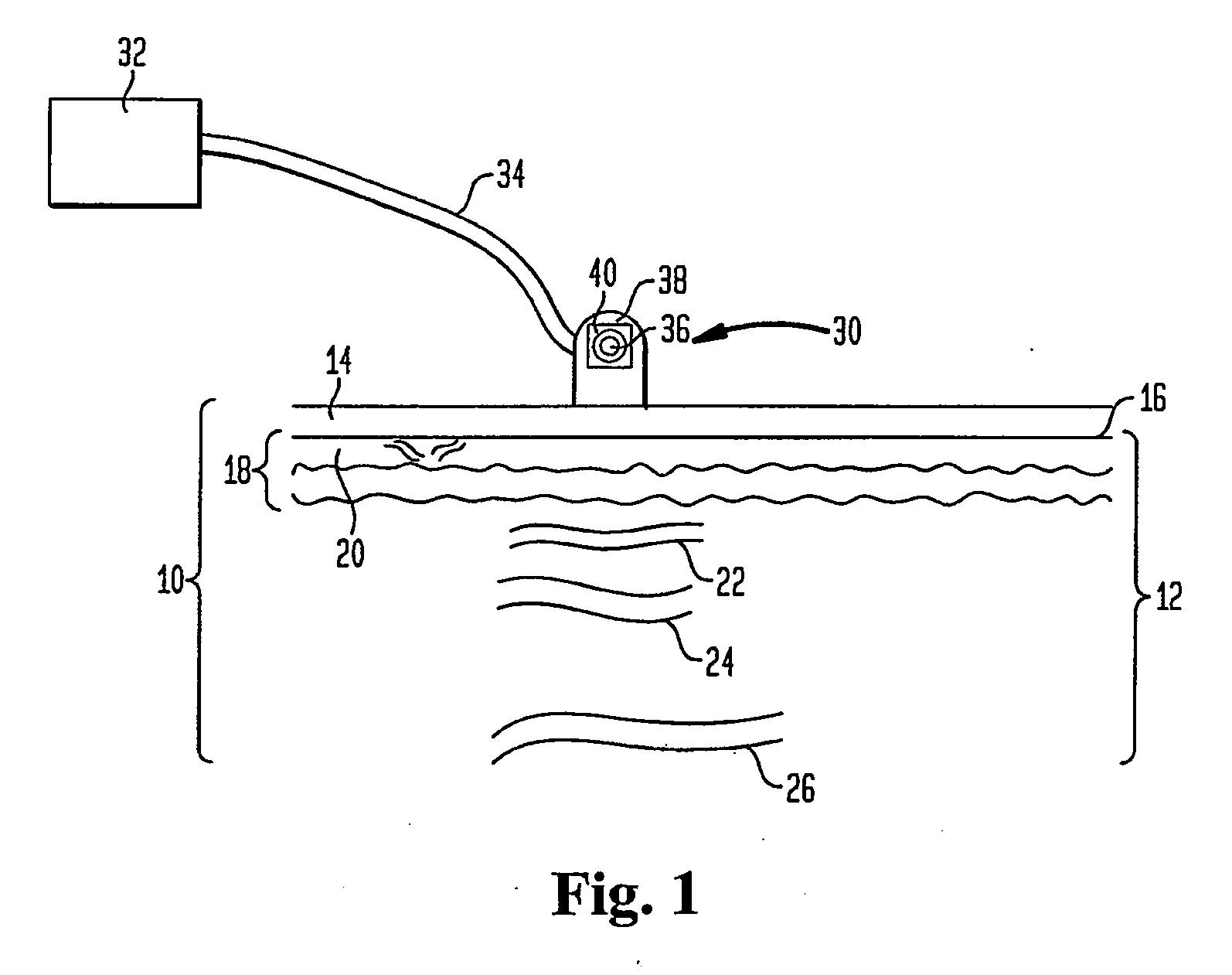 Method And Apparatus For Improved Vascular Related Treatment