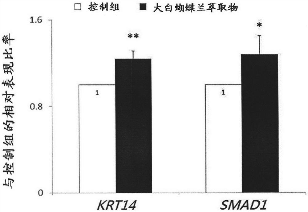 Application of phaaenopsis Sogo Yukidian ukid extract for preparation of composition for resisting glycation and improving appearance of skin