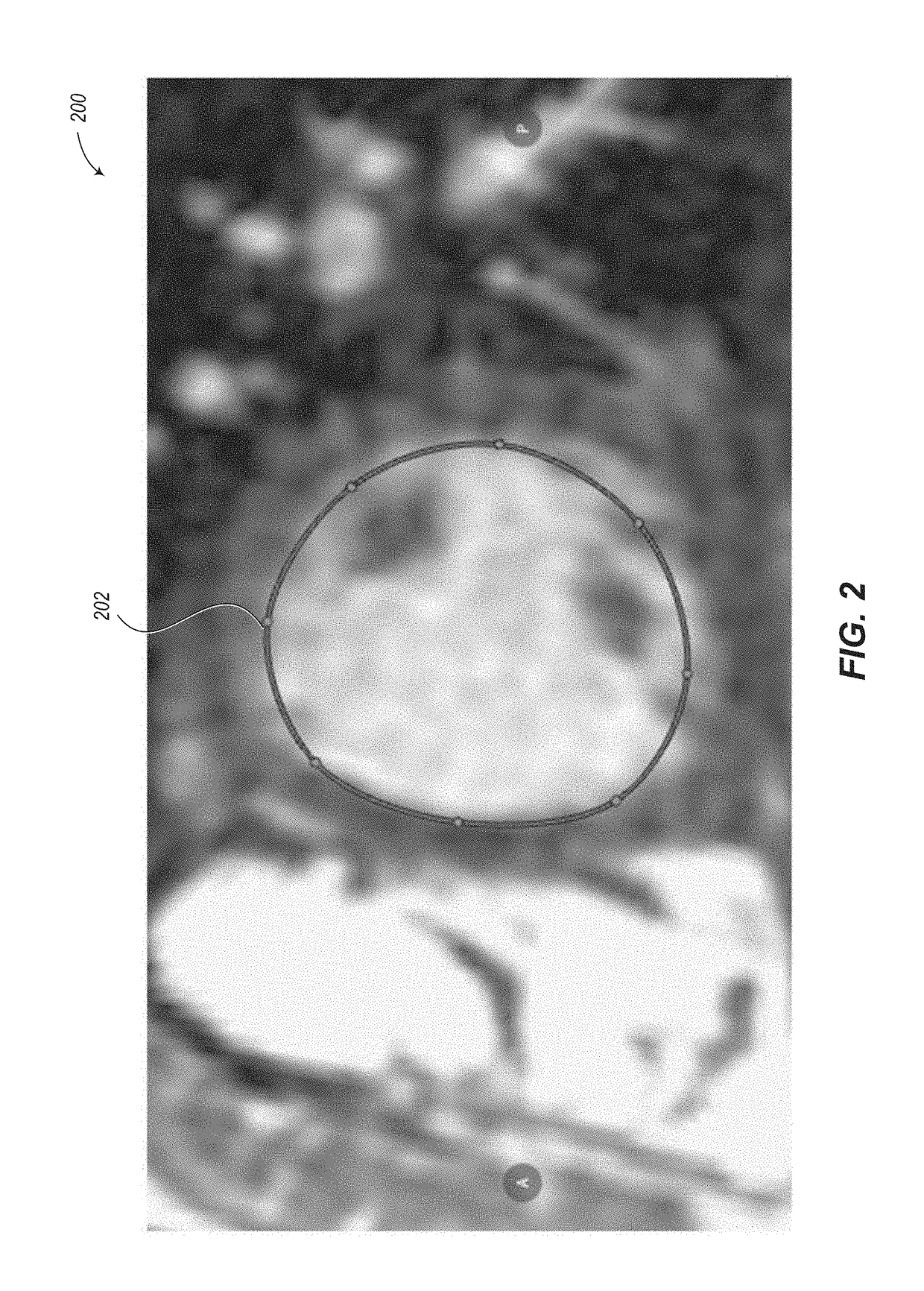 Automated segmentation utilizing fully convolutional networks